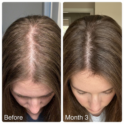Hair Growth Vitamin Biotin Gummies - Wild Berry